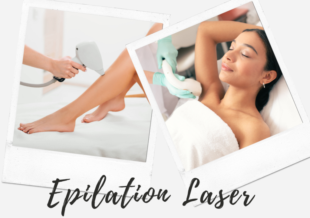 Epilation Laser Prix